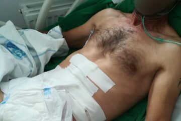 Victima agresiunii sălbatice