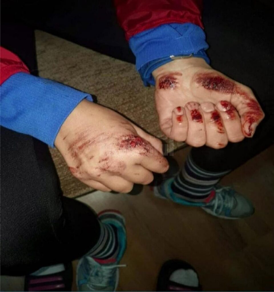 Mâinile Gianinei Belegă, roase până la sânge