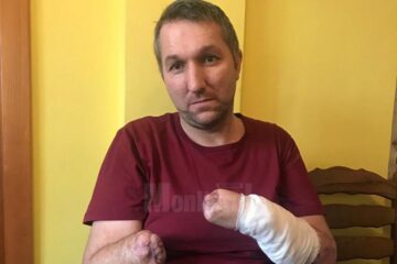 Constantin Cazac, în vârstă de 40 de ani, cu ambele mâini amputate, în urma unui accident, are nevoie urgent de două proteze