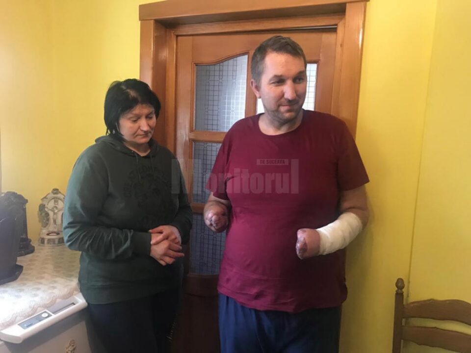 Un bărbat din Bădeuți cu ambele mâini amputate are nevoie urgent de proteze