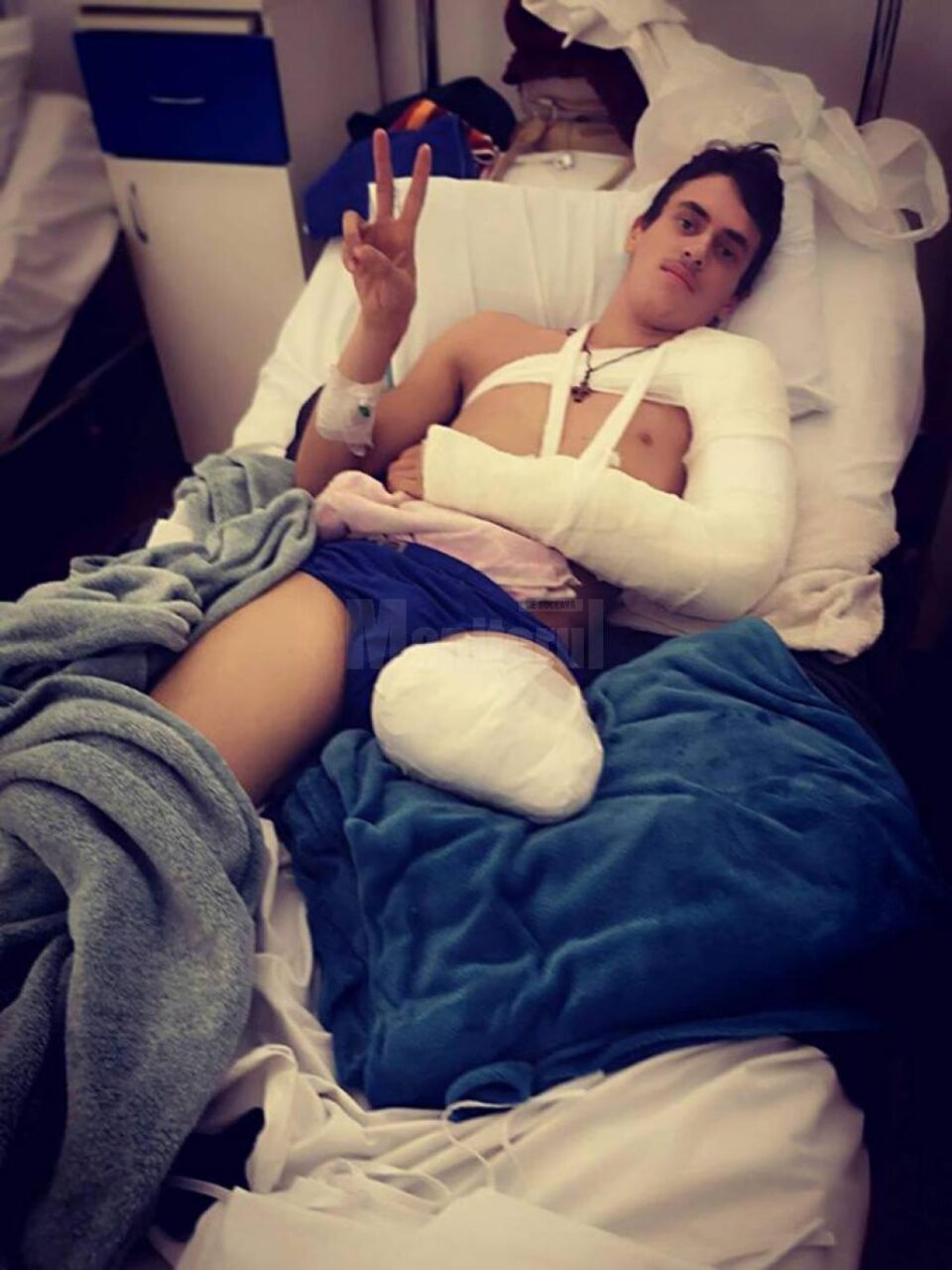 Florin-Alexandru Floriștean, tânărul din Capu Câmpului rămas fără un picior în urma unui accident rutier are nevoie în continuare de ajutor