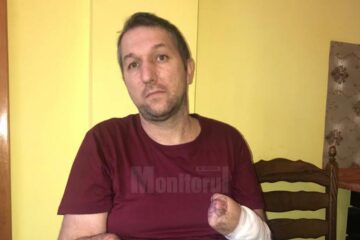 Constantin Cazac, în vârstă de 40 de ani, cu ambele mâini amputate, în urma unui accident, are nevoie urgent de două proteze