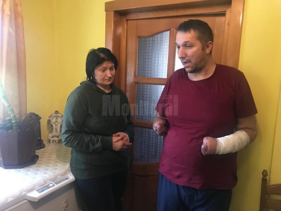 Bărbatul din Bădeuți cu ambele mâini amputate are nevoie în continuare de ajutor pentru a-și cumpăra proteze