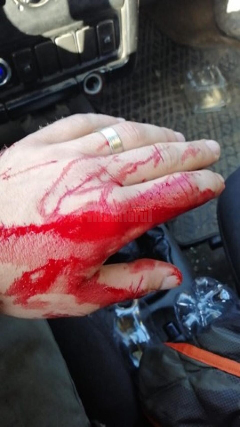 Pădurarul din Moldovița, care apare în filmarea Recorder despre hoții de lemne, a fost bătut FOTO legeacodrului.ro