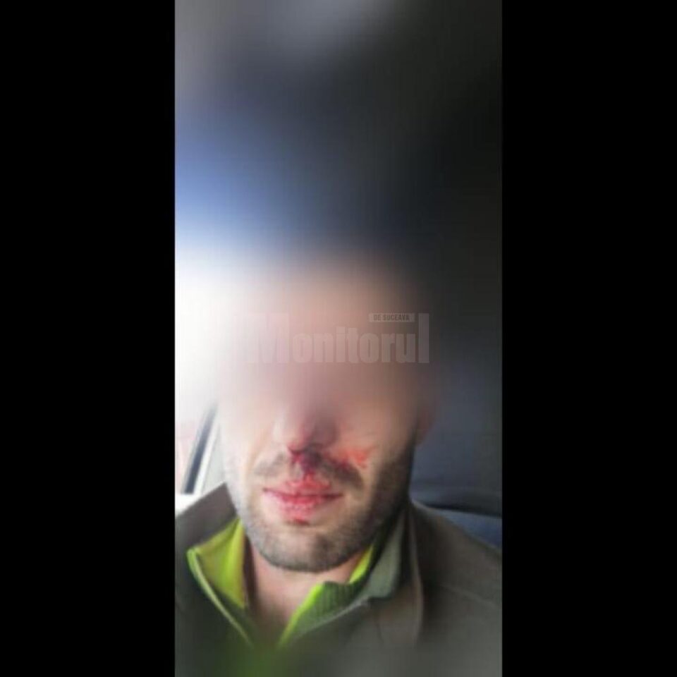 Pădurarul din Moldovița, care apare în filmarea Recorder despre hoții de lemne, a fost bătut FOTO legeacodrului.ro