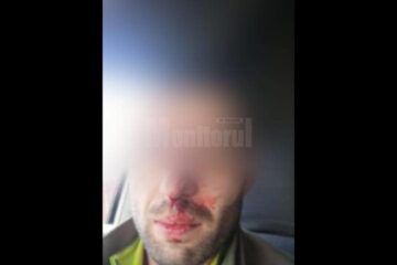 Pădurarul din Moldovița, care apare în filmarea Recorder despre hoții de lemne, a fost bătut FOTO legeacodrului.ro