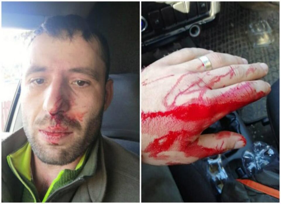 Pădurarul Răzvan Cenușă, după altercația cu patronul unei vulcanizări, implicat în afaceri cu lemn, în Moldovița - Foto: recorder.ro Pădurarul Răzvan Cenușă, după altercația cu patronul unei vulcanizări, implicat în afaceri cu lemn, în Moldovița - Foto: recorder.ro