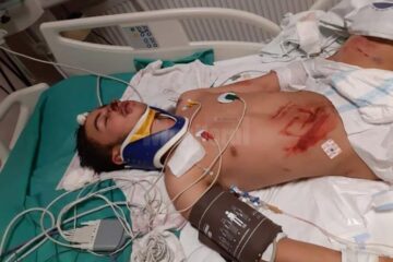 Adolescentul pe patul de spital