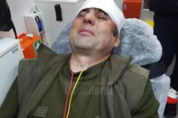 Paznicul de vanatoare Ilie Drob a ajuns la spital cu un traumatism cranio cerebral puternic