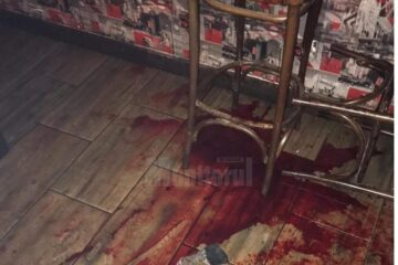 Agentul de pază a sângerat abundent