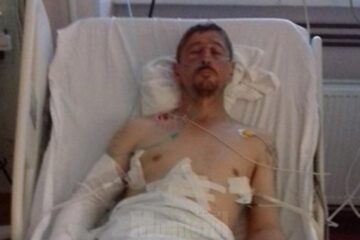 Gavriluț Flocea a încasat o bătaie soră cu moartea, suferind multiple leziuni grave după ce a fost bătut cu două răngi, un topor și leațuri smulse dintr-un gard Gavriluț Flocea a încasat o bătaie soră cu moartea, suferind multiple leziuni grave după ce a fost bătut cu două răngi, un topor și leațuri smulse dintr-un gard