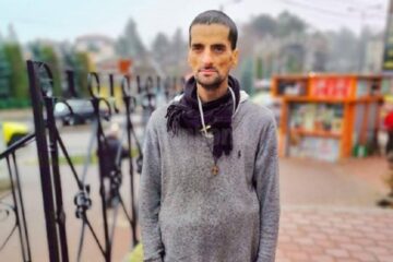 Niculae Stanarache: ”Sunt un băiat necăjit fără degete și fără părinți din Suceava. Mă puteți ajuta cu ceva de mâncare?”