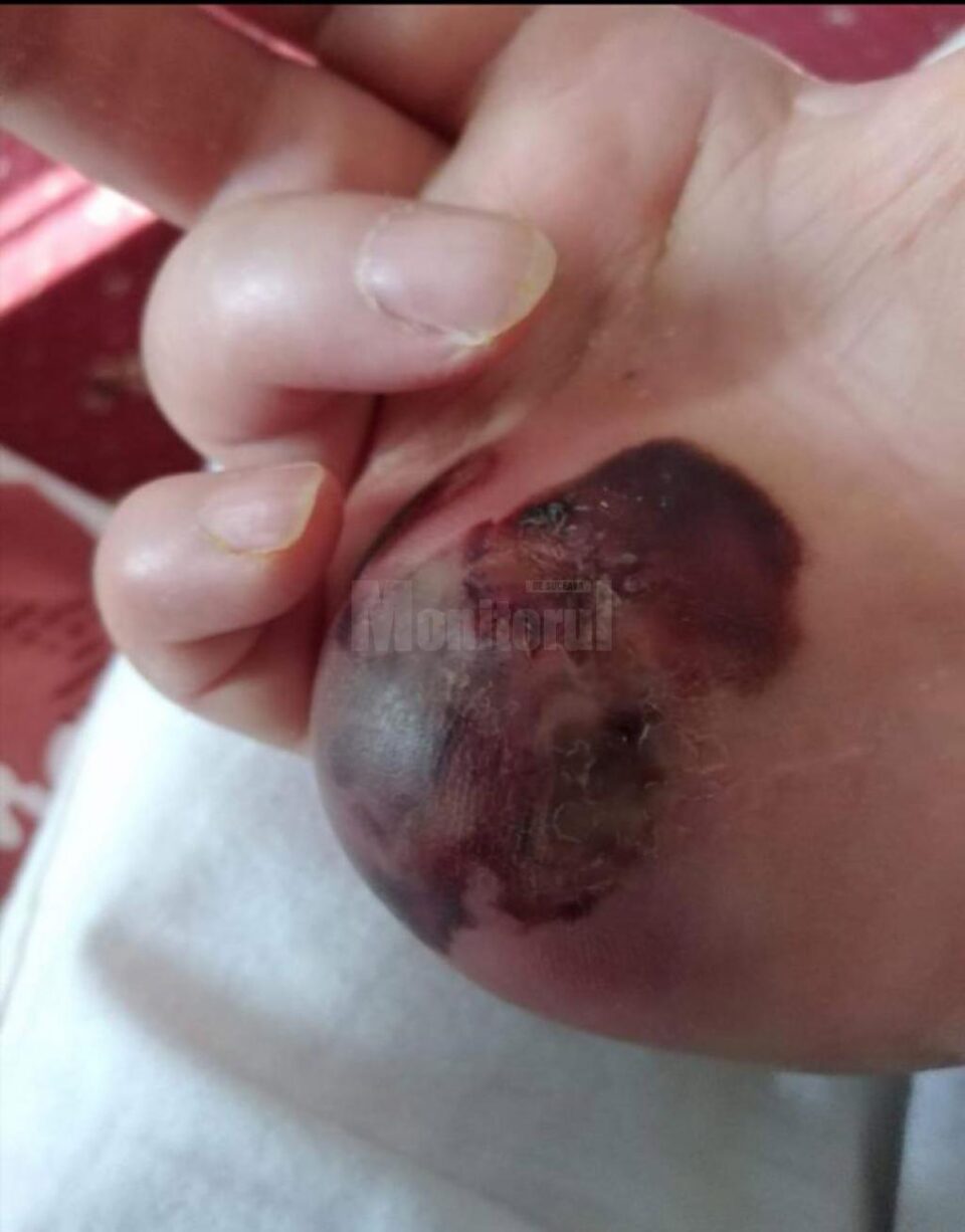 Dorina-Constanța Baboi suferă de o boală rară și are nevoie de ajutor