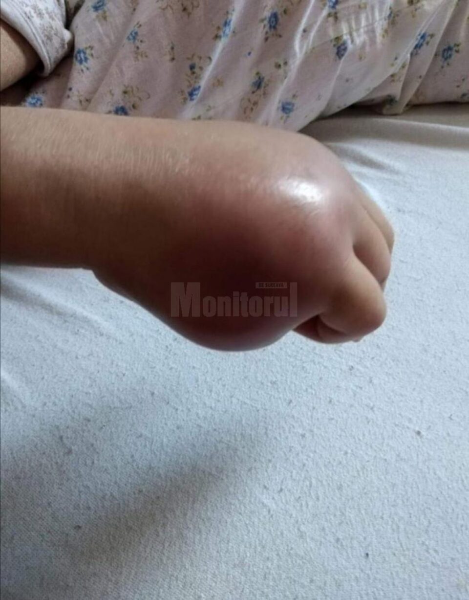 Dorina-Constanța Baboi suferă de o boală rară și are nevoie de ajutor