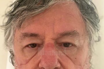 Dr. Ștefan Pînzariu, cu urmele adânci lăsate pe față de masca de protecție