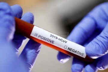 Încă 8 cazuri de Covid confirmate în focarul de la Vama Sursa foto europafm.ro