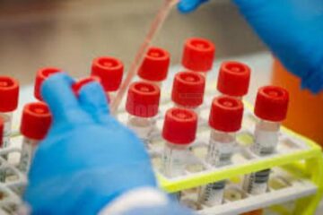 Încă două laboratoare din județ fac teste Covid pentru vacanță Sursa realitatea.net