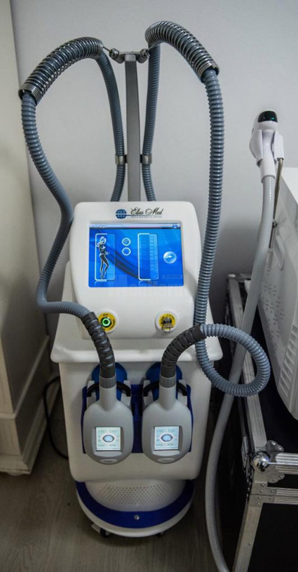 Tratament revoluționar pentru slăbit prin criolipoliză