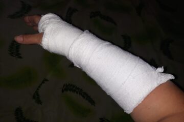 Taxatoarea are acum mâna în ghips, certificatul medico-legal atestând că are nevoie de 14 zile de îngrijiri medicale