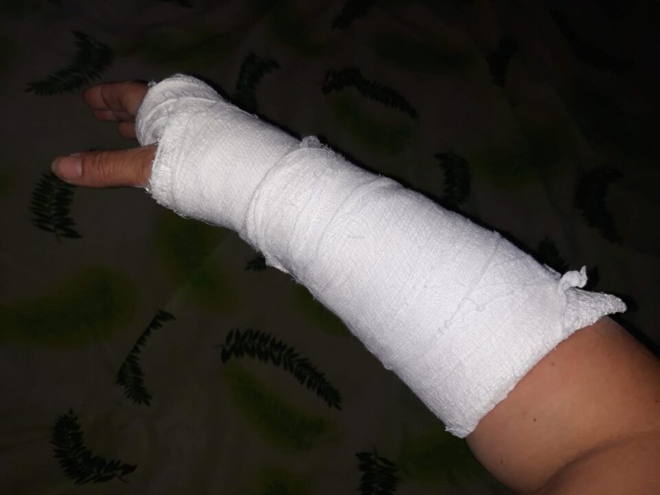 Taxatoarea are acum mâna în ghips, certificatul medico-legal atestând că are nevoie de 14 zile de îngrijiri medicale