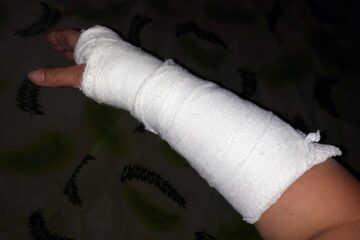 Taxatoarea are acum mâna în ghips, certificatul medico-legal atestând că are nevoie de 14 zile de îngrijiri medicale