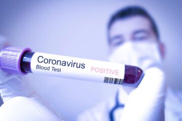 70 de cazuri noi de Covid, joi, în județul Suceava Sursa jurnalulolteniei.ro