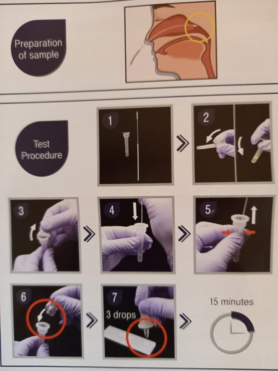 Opt suceveni cu rezultat negativ la testul rapid antigen pentru Covid-19, diagnosticați pozitiv la testul RT PCR