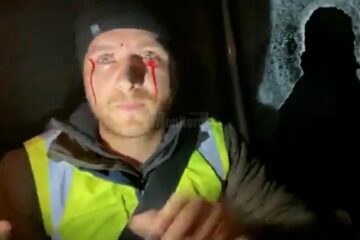 Activistul Bodnar, rănit în urma unui atac cu bolovani, la un gater din Mălini