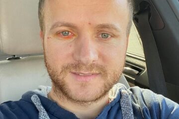 Daniel Bodnar a fost operat ieri de o echipă de la Spitalul de Neurochirurgie Iași