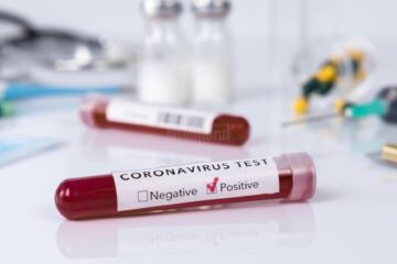 În urma testelor efectuate la nivel național au fost înregistrate 2.699 cazuri noi de persoane infectate cu SARS – CoV – 2