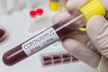 Comuna Rădășeni, în scenariul galben până pe 9 aprilie