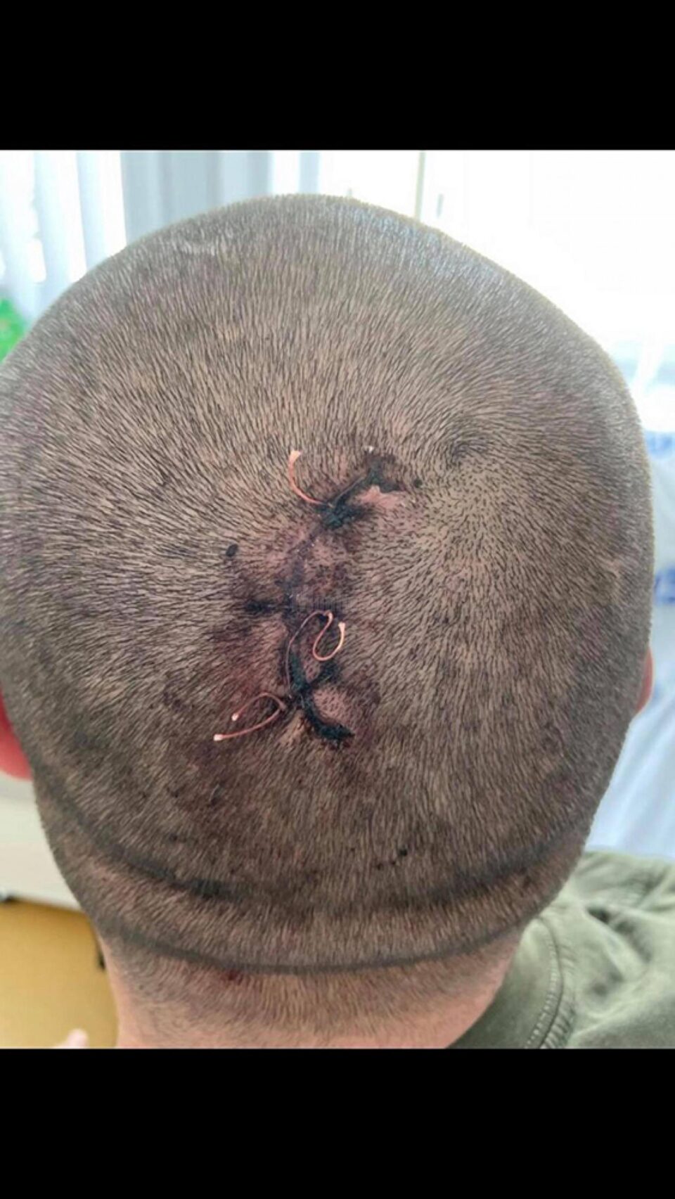 Tânărul bătut la Straja