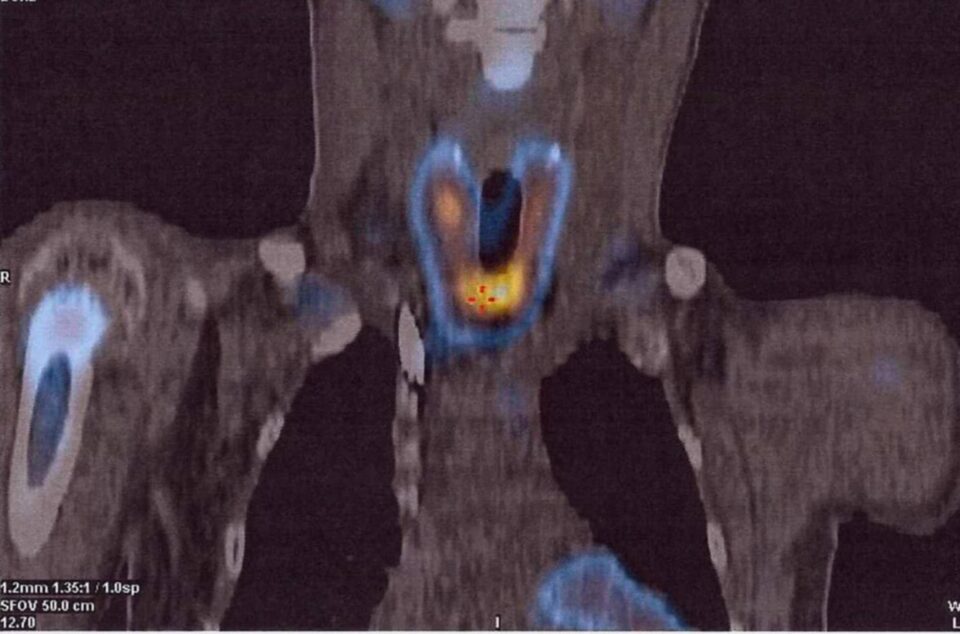 Imagini PET CT