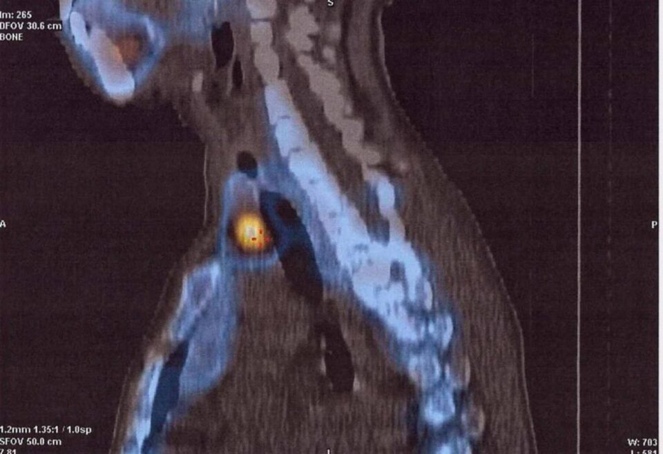 Imagini PET CT