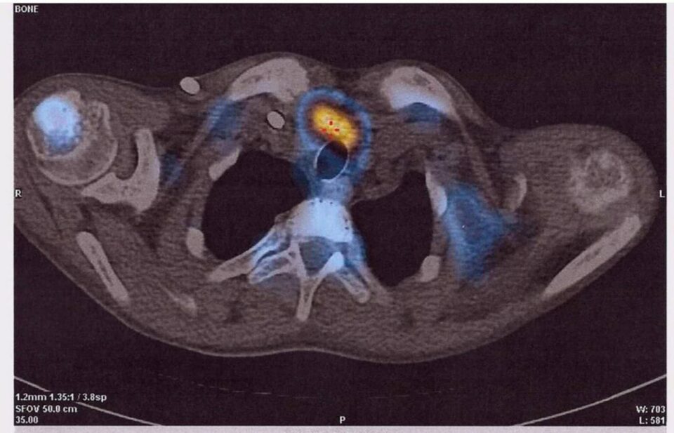 Imagini PET CT