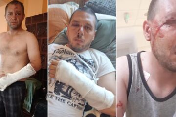 Cei doi frați au încasat o bătaie soră cu moartea