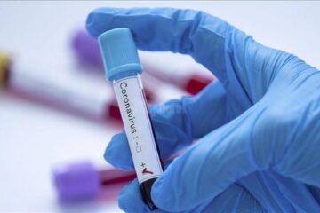 Un singur caz nou de coronavirus în județul Suceava la 238 de persoane testate