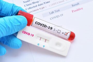 Comuna Adâncata a intrat în scenariul galben, cu o rată de infectare de 2,29 la mie