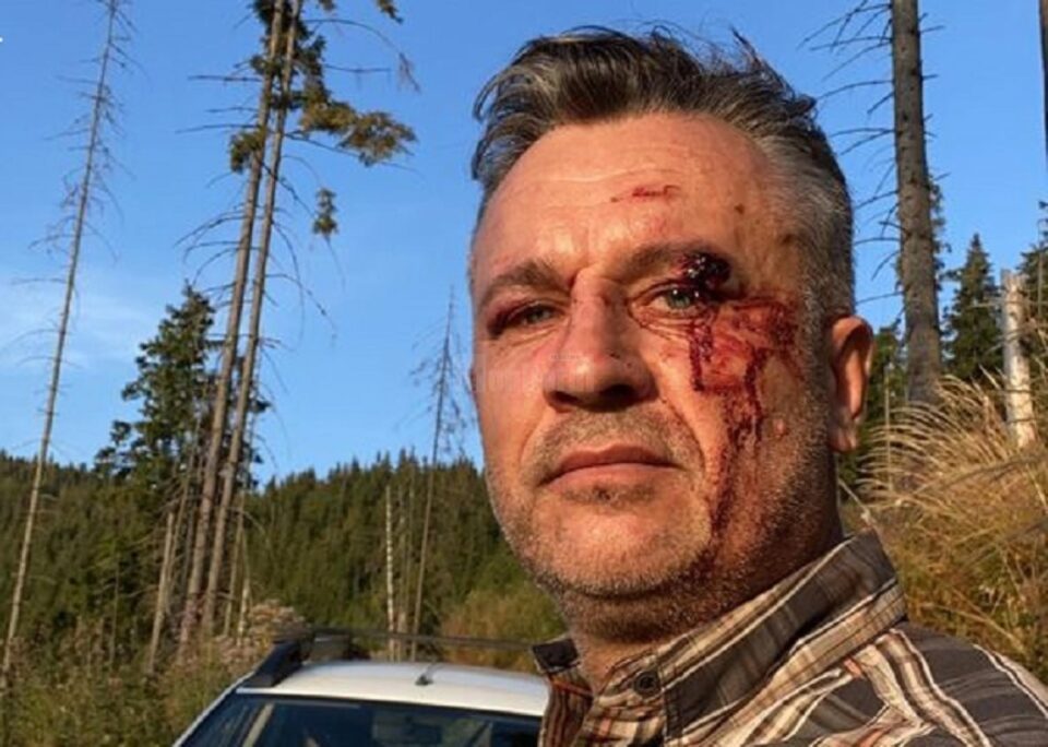 Activistul Tiberiu Boșutar, agresat în urma unei altercații în pădure - FOTO Facebook Legea codrului Activistul Tiberiu Boșutar, agresat în urma unei altercații în pădure - FOTO Facebook Legea codrului