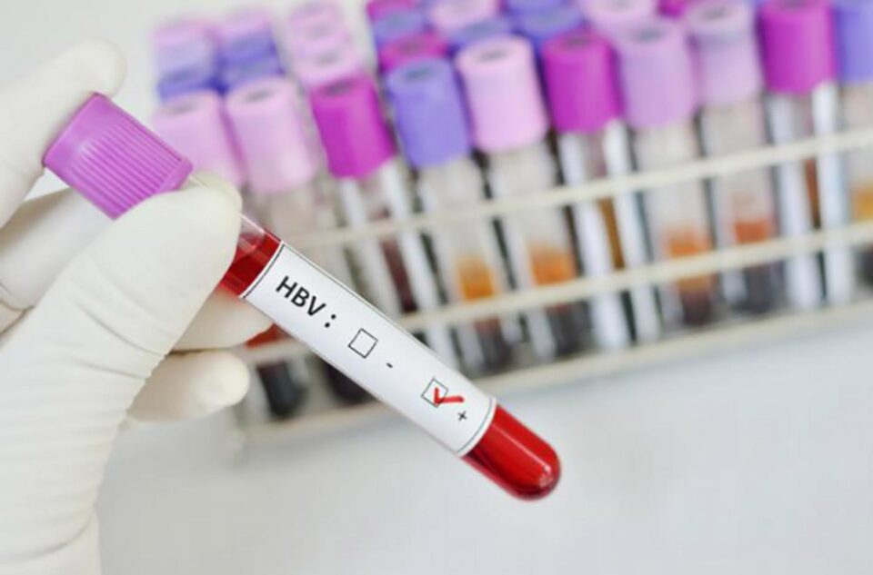 Medicii de familie, invitați să se înscrie în programul de depistare a hepatitelor la pacienții lor Sursa foto hepato.ro Medicii de familie, invitați să se înscrie în programul de depistare a hepatitelor la pacienții lor Sursa foto hepato.ro