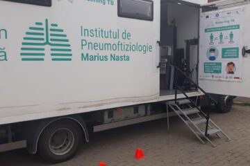 Din peste 2.700 de suceveni testați gratuit pentru TBC, la 155 există suspiciunea că ar avea tuberculoză