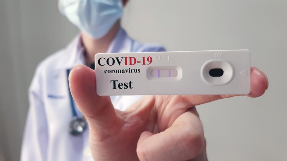 Test antigen COVID-19