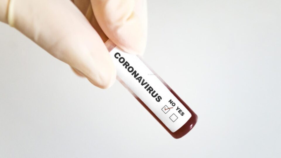 Test coronavirus