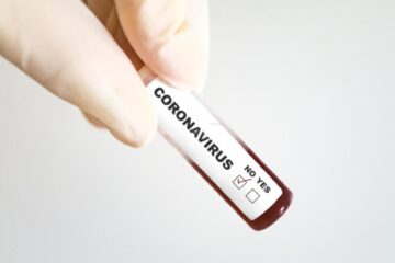 Test coronavirus