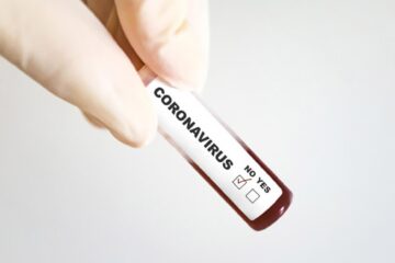 Test coronavirus