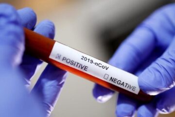 Luni au fost înregistrate 6 cazuri noi, din 422 de persoane testate