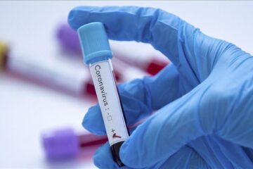 Joi: 20 de cazuri noi de Covid, din 860 de persoane testate, în județul Suceava