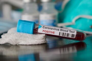 De sâmbătă și până duminică au fost raportate doar 12 cazuri noi de Covid-19 Sursa digi24.ro