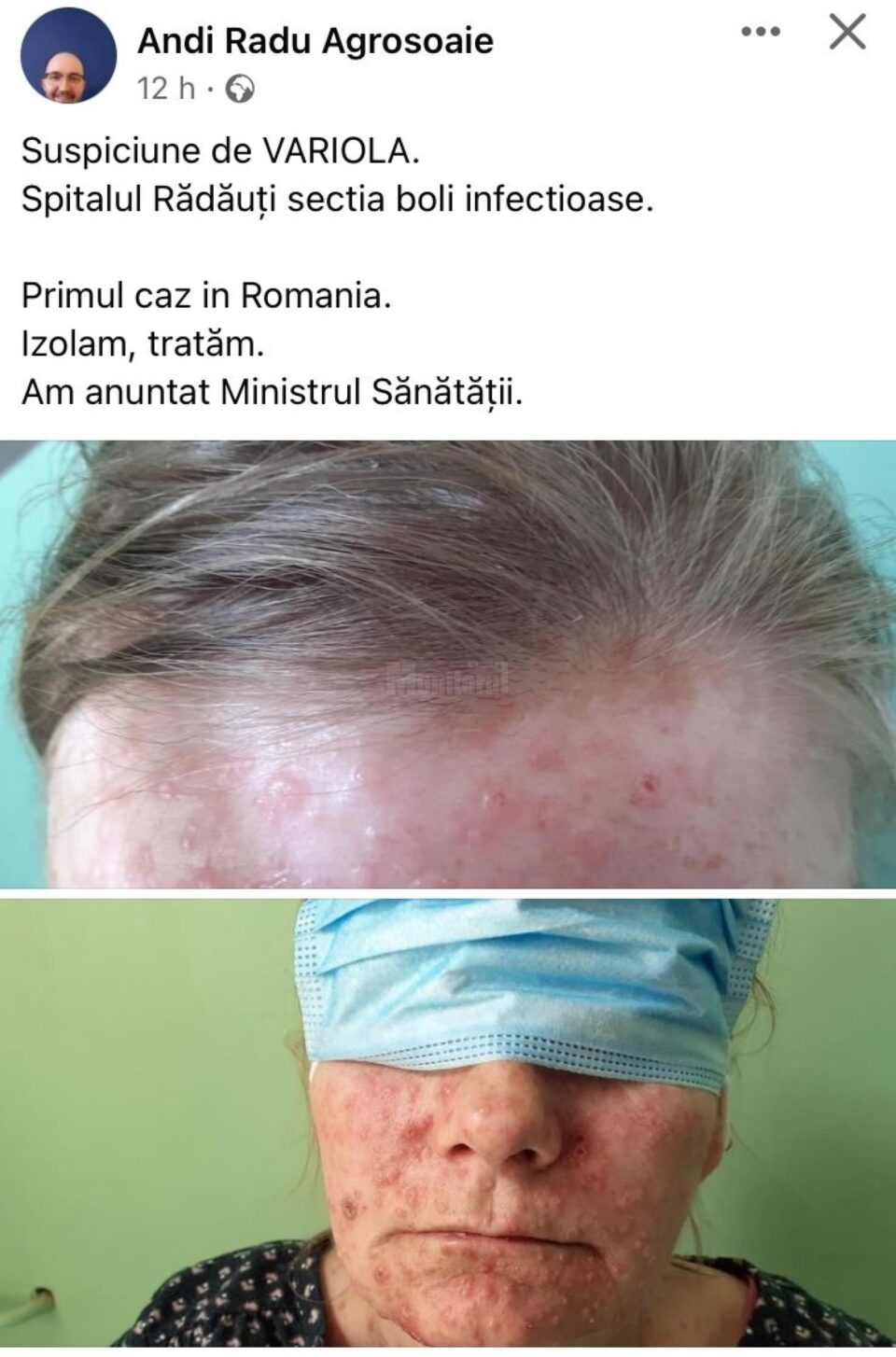 Postarea medicului de la Rădăuți