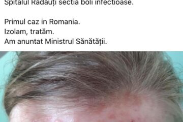 Postarea medicului de la Rădăuți